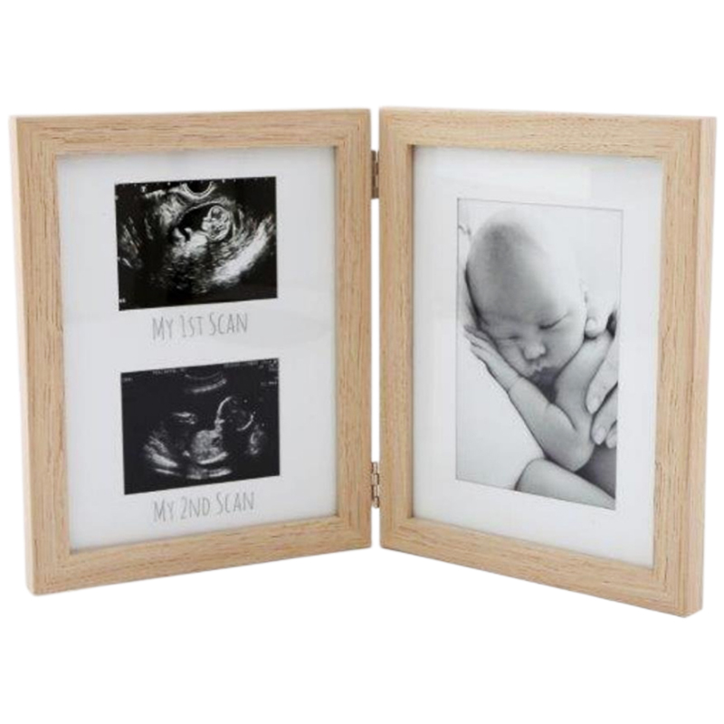 5cm | 014.BB0335 | Baby's First Photos Frame - Box In Θεσσαλονίκη - 25ης Μαρτίου 111